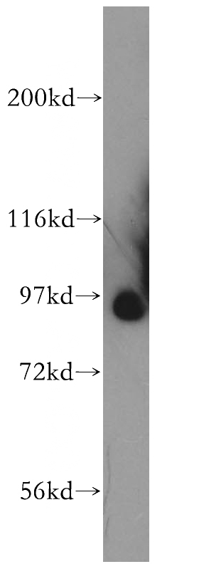 mouse thymus tissue were subjected to SDS PAGE followed by western blot with Catalog No:115359(SLITRK4 antibody) at dilution of 1:500