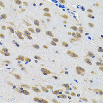 Immunohistochemistry - LGR6 Polyclonal Antibody 