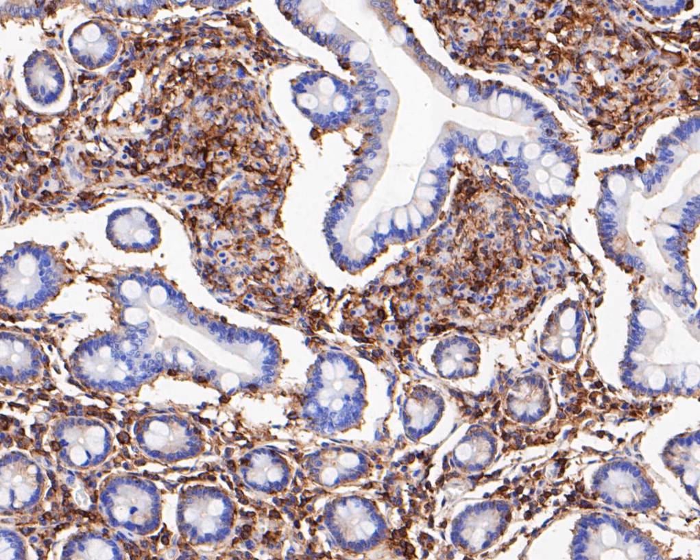 Fig6: Immunohistochemical analysis of paraffin-embedded human small intestine tissue using anti-SPATIAL antibody. The section was pre-treated using heat mediated antigen retrieval with Tris-EDTA buffer (pH 8.0-8.4) for 20 minutes.The tissues were blocked in 5% BSA for 30 minutes at room temperature, washed with ddH2O and PBS, and then probed with the primary antibody ( 1/200) for 30 minutes at room temperature. The detection was performed using an HRP conjugated compact polymer system. DAB was used as the chromogen. Tissues were counterstained with hematoxylin and mounted with DPX.