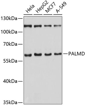 Western blot - PALMD Polyclonal Antibody 