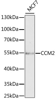 Western blot - CCM2 Polyclonal Antibody 