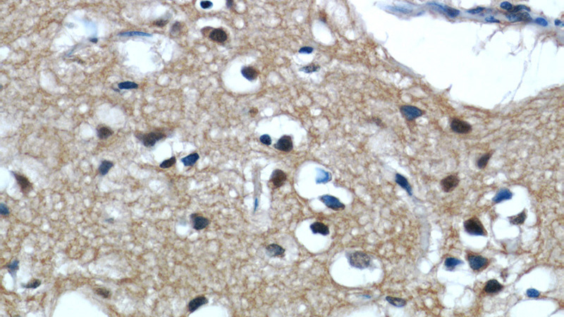 Immunohistochemical of paraffin-embedded human brain using Catalog No:111785(IMPDH2 antibody) at dilution of 1:50 (under 40x lens)