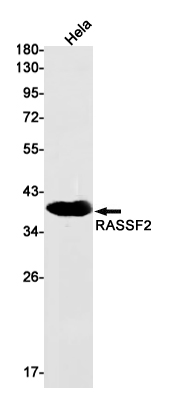 Western blot detection of RASSF2 in Hela cell lysates using RASSF2 Rabbit mAb(1:1000 diluted).Predicted band size:38kDa.Observed band size:38kDa.