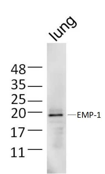 Fig1: Sample:; Lung (Mouse) Lysate at 40 ug; Primary: Anti-EMP-1 at 1/300 dilution; Secondary: IRDye800CW Goat Anti-Rabbit IgG at 1/20000 dilution; Predicted band size: 17 kD; Observed band size: 19 kD