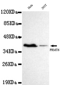 Western blot detection of PRMT6 in Hela and 293T cell lysates using PRMT6 mouse mAb (1:1000 diluted).Predicted band size: 42KDa.Observed band size: 42KDa.