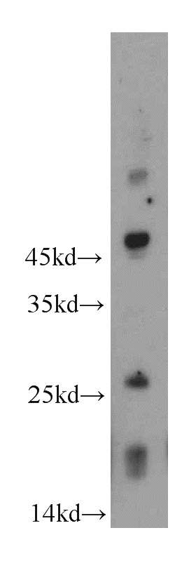 human brain tissue were subjected to SDS PAGE followed by western blot with Catalog No:114748(RNF170 antibody) at dilution of 1:500