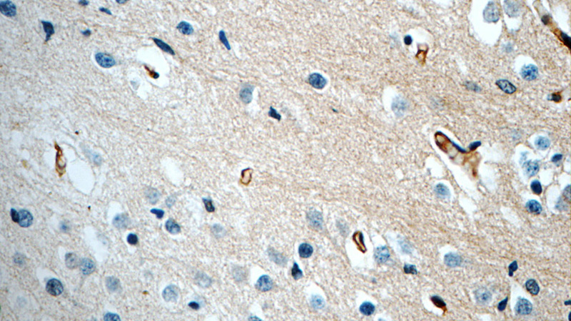 Immunohistochemistry of paraffin-embedded human brain tissue slide using Catalog No:113731(PEX5L Antibody) at dilution of 1:50 (under 40x lens)
