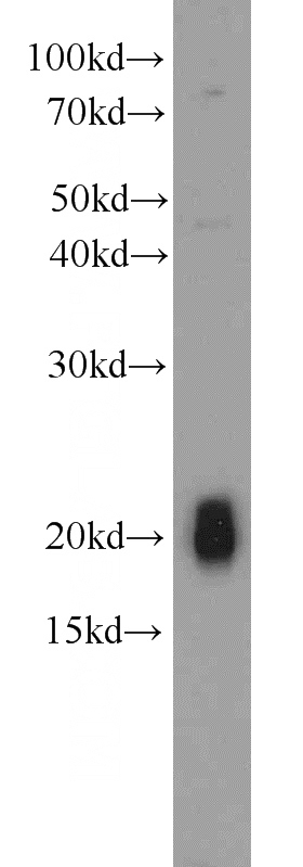 HT-1080 cells were subjected to SDS PAGE followed by western blot with Catalog No:113210(NPC2 antibody) at dilution of 1:600
