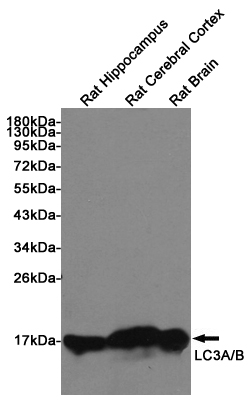 Western blot detection of LC3A/B in Rat Hippocampus, Rat Cerebral Cortex and Rat Brain lysates using LC3A/B Rabbit pAb (1:1000 diluted). Predicted band size: 15KDa. Observed band size:14, 16KDa.