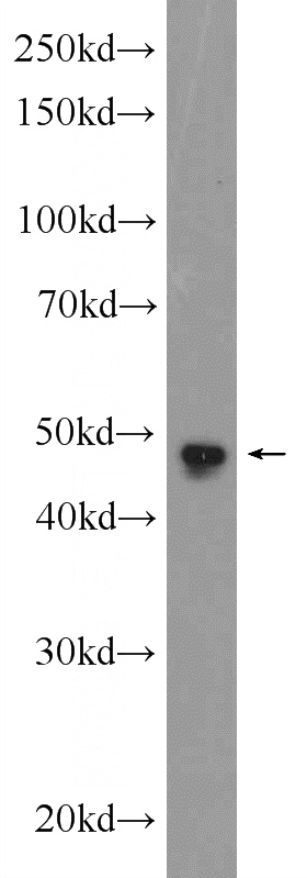 HEK-293 cells were subjected to SDS PAGE followed by western blot with Catalog No:115290(SKP2 Antibody) at dilution of 1:600