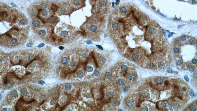 Immunohistochemistry of paraffin-embedded human kidney tissue slide using Catalog No:115169(SLC5A2 Antibody) at dilution of 1:200 (under 40x lens)
