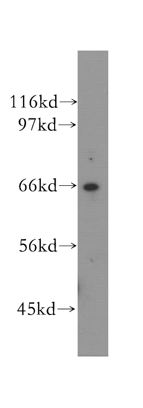 human kidney tissue were subjected to SDS PAGE followed by western blot with Catalog No:116790(VPS45 antibody) at dilution of 1:500