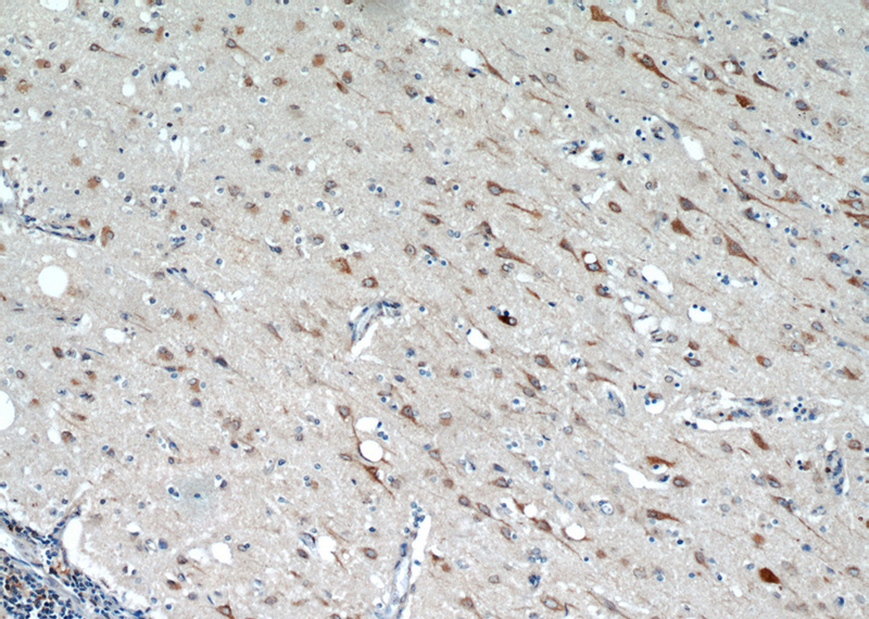 Immunohistochemical of paraffin-embedded human brain using Catalog No:116284(TMX4 antibody) at dilution of 1:50 (under 10x lens)