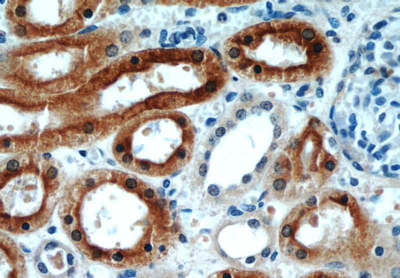 Immunohistochemical of paraffin-embedded human kidney using Catalog No:109703(CYP4A11 antibody) at dilution of 1:50 (under 40x lens)