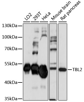 Western blot - TBL2 Polyclonal Antibody 