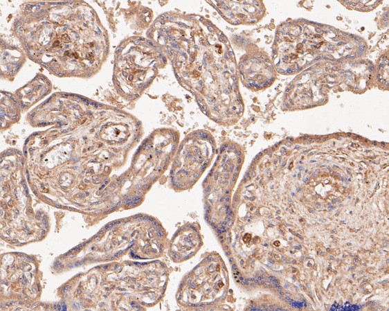Fig5: Immunohistochemical analysis of paraffin-embedded human placenta tissue using anti-SPATIAL antibody. The section was pre-treated using heat mediated antigen retrieval with Tris-EDTA buffer (pH 8.0-8.4) for 20 minutes.The tissues were blocked in 5% BSA for 30 minutes at room temperature, washed with ddH2O and PBS, and then probed with the primary antibody ( 1/50) for 30 minutes at room temperature. The detection was performed using an HRP conjugated compact polymer system. DAB was used as the chromogen. Tissues were counterstained with hematoxylin and mounted with DPX.