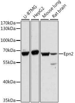Western blot - Epn2 Polyclonal Antibody 