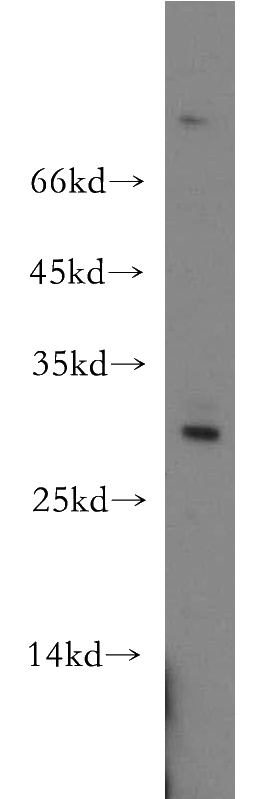 mouse testis tissue were subjected to SDS PAGE followed by western blot with Catalog No:116629(UPK2 antibody) at dilution of 1:500