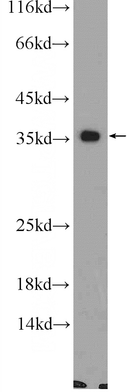 mouse colon tissue were subjected to SDS PAGE followed by western blot with Catalog No:109360(CNTD1 Antibody) at dilution of 1:600