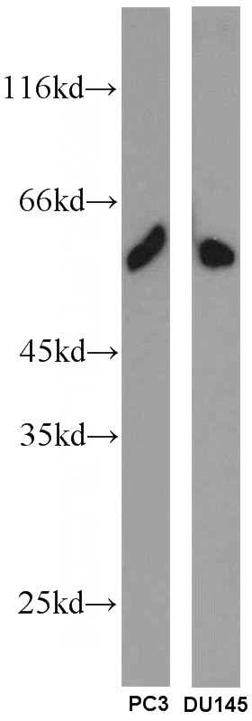 PC-3 cells were subjected to SDS PAGE followed by western blot with Catalog No:115657(SPZ1 antibody) at dilution of 1:1000