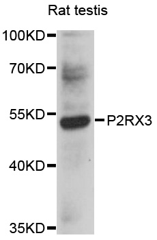 Western blot - P2RX3 Polyclonal Antibody 