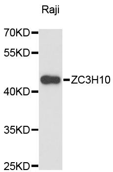 Western blot - ZC3H10 Polyclonal Antibody 
