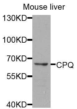 Western blot - CPQ Polyclonal Antibody 