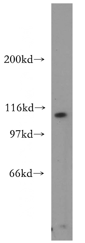 NIH/3T3 cells were subjected to SDS PAGE followed by western blot with Catalog No:108123(AP3D1 antibody) at dilution of 1:300