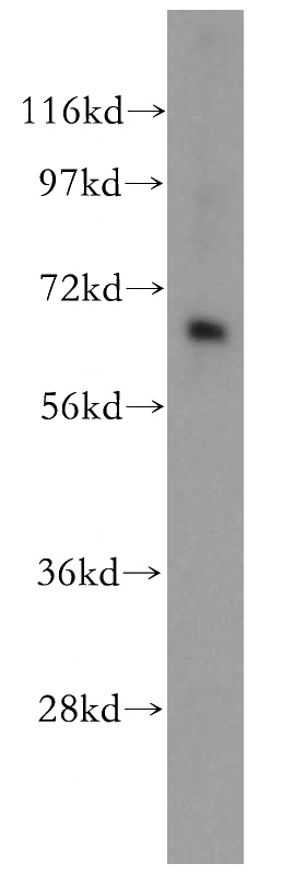 human heart tissue were subjected to SDS PAGE followed by western blot with Catalog No:109538(CRAT antibody) at dilution of 1:300