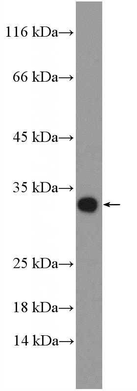 mouse kidney tissue were subjected to SDS PAGE followed by western blot with Catalog No:117255(ZNRF2-Specific Antibody) at dilution of 1:300