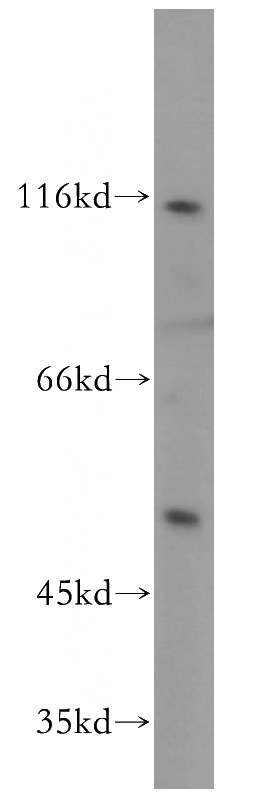 A431 cells were subjected to SDS PAGE followed by western blot with Catalog No:113155(NFKB1,p105,p50-Specific antibody) at dilution of 1:200