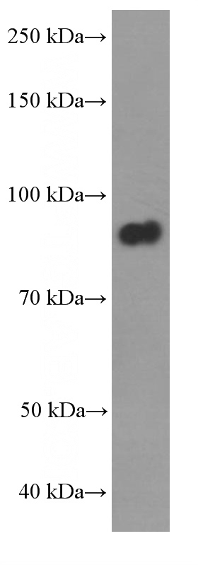 fetal human brain tissue were subjected to SDS PAGE followed by western blot with Catalog No:107236(DBC1 Antibody) at dilution of 1:1000