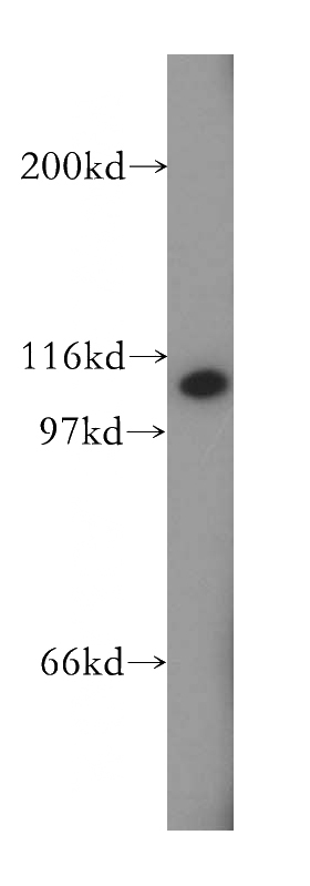 human brain tissue were subjected to SDS PAGE followed by western blot with Catalog No:116795(VPS54 antibody) at dilution of 1:300