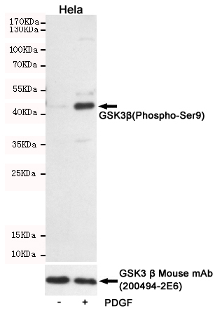 Western blot detection of GSK3u03b2(Phospho-Ser9) in Hela cells untreated or PDGF-treated, using GSK3u03b2(Phospho-Ser9) Rabbit pAb (dilution 1:2000, upper) or GSK3 u03b2 Mouse mAbn (200494-2E6 dilution 1:1000, lower).Predicted band size:46kDa.Observed band size:46kDa.