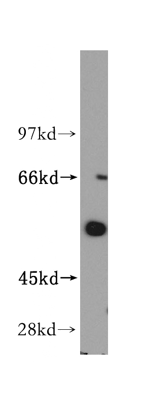 mouse brain tissue were subjected to SDS PAGE followed by western blot with Catalog No:111957(ITPKA antibody) at dilution of 1:500