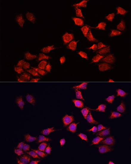 Immunofluorescence - BNIP3 Polyclonal Antibody 