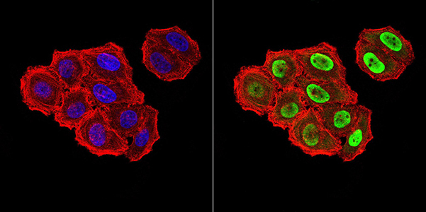 Fig4: ICC staining ZFP91 (green) and Actin filaments (red) in Hela cells. The nuclear counter stain is DAPI (blue). Cells were fixed in paraformaldehyde, permeabilised with 0.25% Triton X100/PBS.