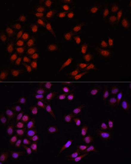 Immunofluorescence - PRDM14 Polyclonal Antibody 