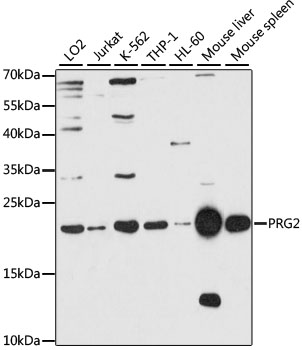 Western blot - PRG2 Polyclonal Antibody 