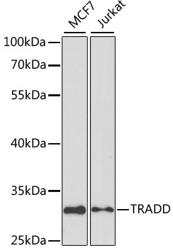 Western blot - TRADD Polyclonal Antibody 