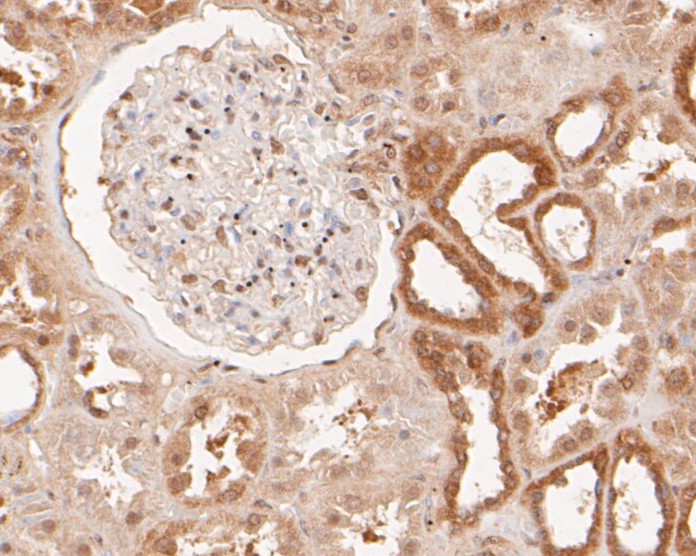 Fig4:; Immunohistochemical analysis of paraffin-embedded human kidney tissue using anti-KCNK2 antibody. The section was pre-treated using heat mediated antigen retrieval with Tris-EDTA buffer (pH 8.0-8.4) for 20 minutes.The tissues were blocked in 5% BSA for 30 minutes at room temperature, washed with ddH; 2; O and PBS, and then probed with the primary antibody ( 1/100) for 30 minutes at room temperature. The detection was performed using an HRP conjugated compact polymer system. DAB was used as the chromogen. Tissues were counterstained with hematoxylin and mounted with DPX.