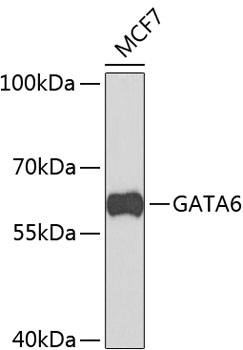 Western blot - GATA6 Polyclonal Antibody 