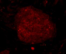 Fig2: ICC staining C19orf35 in human embryonic stem cells (red). Cells were fixed in paraformaldehyde, permeabilised with 0.25% Triton X100/PBS.