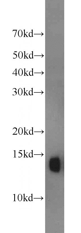 K-562 cells were subjected to SDS PAGE followed by western blot with Catalog No:111287(HBA1 antibody) at dilution of 1:1000