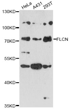 Western blot - FLCN Polyclonal Antibody 