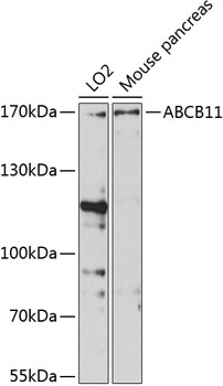 Western blot - ABCB11 Polyclonal Antibody 