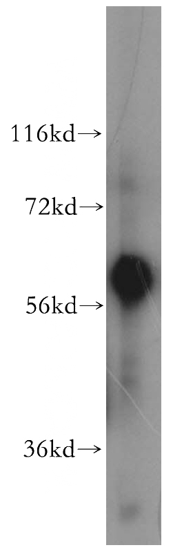 human liver tissue were subjected to SDS PAGE followed by western blot with Catalog No:110623(AHSG antibody) at dilution of 1:500