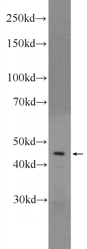 SH-SY5Y cells were subjected to SDS PAGE followed by western blot with Catalog No:109557(CRHR1 Antibody) at dilution of 1:100