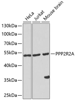Western blot - PPP2R2A Polyclonal Antibody 