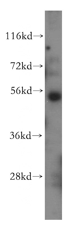 HeLa cells were subjected to SDS PAGE followed by western blot with Catalog No:108535(BTBD1 antibody) at dilution of 1:500